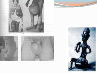 Principais verminoses humanas