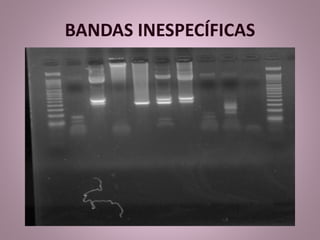BANDAS INESPECÍFICAS 
 
