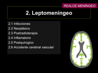 2. Leptomeníngeo
2.1 Infecciones
2.2 Neoplásico
2.3 Postradioterapia
2.4 Inflamatorio
2.5 Postquirúgico
2.6 Accidente cerebral vascular
REALCE MENÍNGEO
 