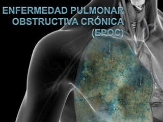EPOC 
Pruebas y exámenes 
 El mejor examen para la EPOC es una prueba simple de la 
función pulmonar llamada espirometría...