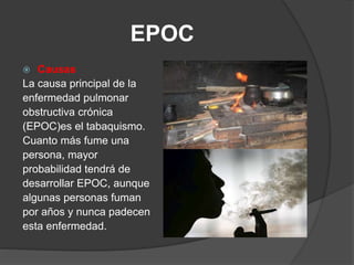 EPOC 
Tratamiento 
 No hay ninguna cura para la EPOC. Sin embargo, hay 
muchas medidas que se pueden tomar para aliviar l...
