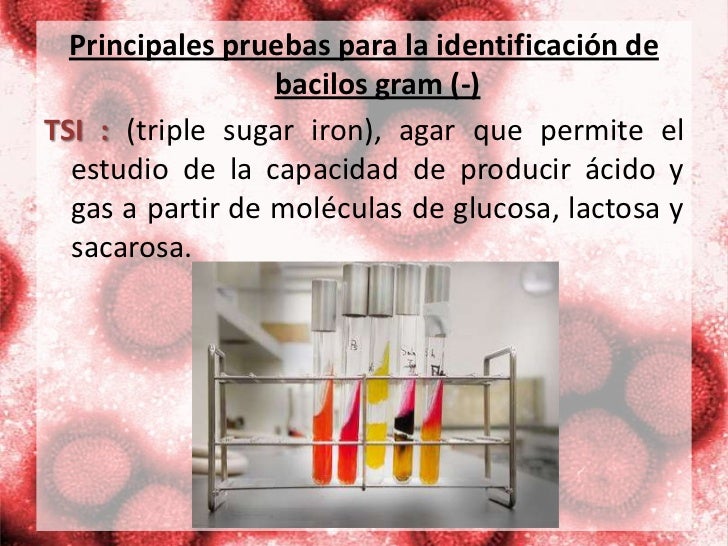 Principales pruebas bioquímicas para la identificación de bacterias