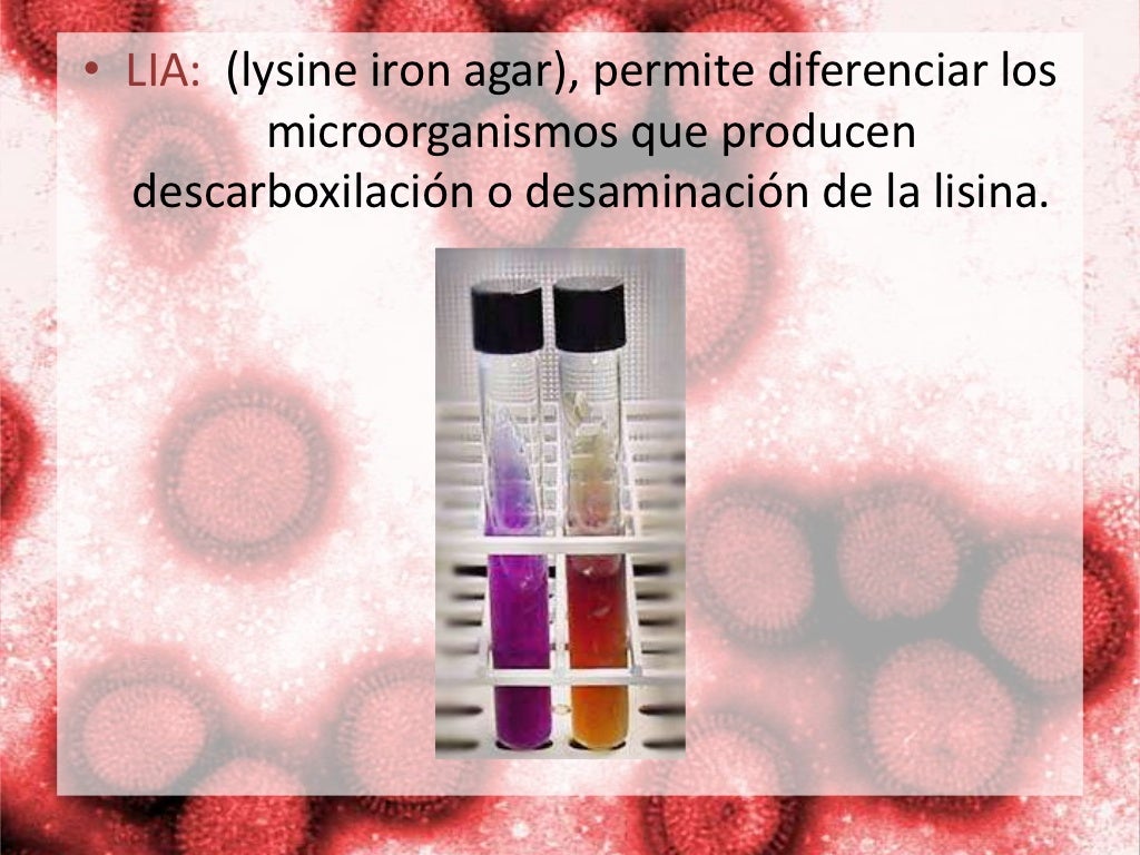 Principales pruebas bioquímicas para la identificación de bacterias