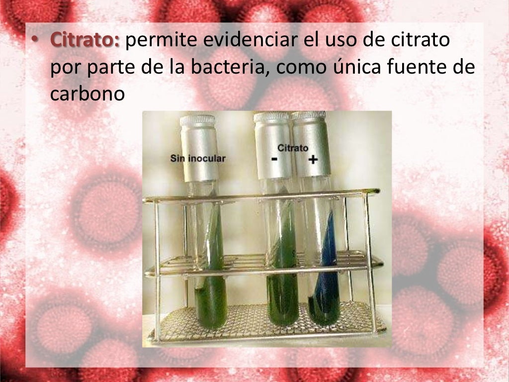 Principales pruebas bioquímicas para la identificación de bacterias