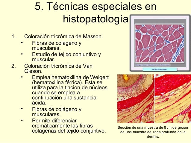 Principales tinciones en el laboratorio de anatomía patológica