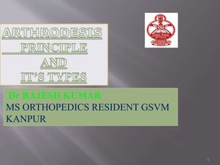 Dr RAJESH KUMAR
MS ORTHOPEDICS RESIDENT GSVM
KANPUR
1
 