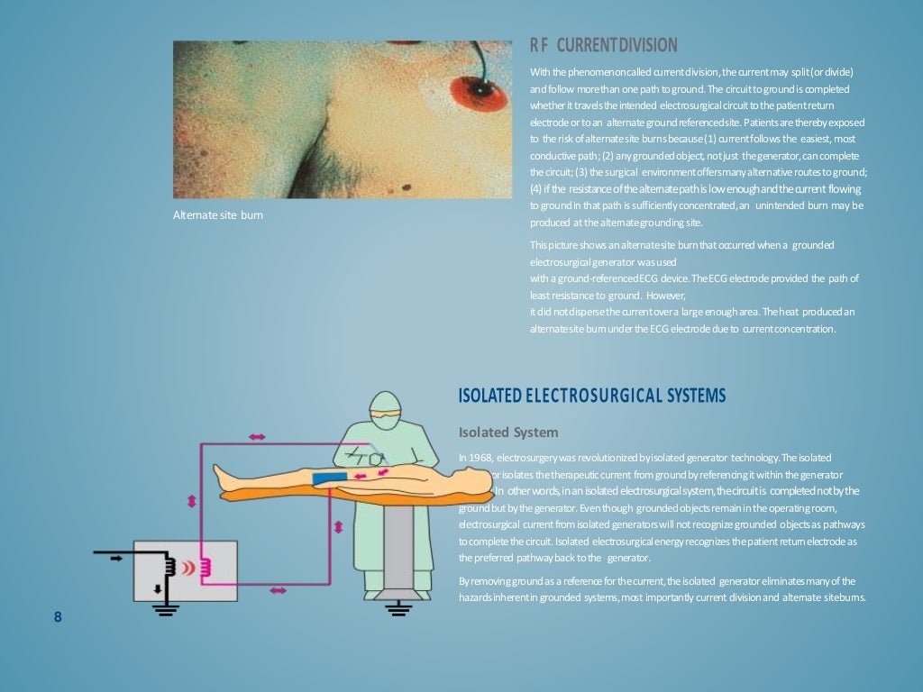 Principles in Electrosurgery