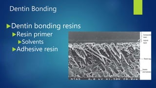 Dentin Bonding
Dentin bonding resins
Resin primer
Solvents
Adhesive resin
24
 