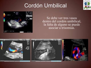 En la semana 12 se puede identificar:Placa corial que es la línea ecogenica que esta en contacto con el Liquido amniótico.Sustancia PlacentariaPlaca Basal que separa la placenta del complejo retroplacentario.A la semana 13 ya podemos observar flujo intervelloso.Grados PlacentariosGrado 0: placa corial y basal lisa. Sustancia placentaria Homogénea
