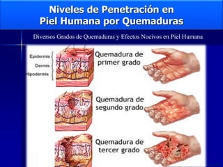 Niveles de Penetración en
Piel Humana por Quemaduras
Capacitación LOCKOUT/TAGOUT-EEHSA Todos los Derechos Reservados © 2011
Diversos Grados de Quemaduras y Efectos Nocivos en Piel Humana
 
