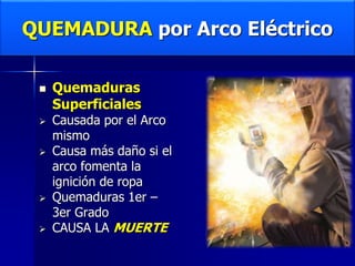 QUEMADURA por Arco Eléctrico
 Quemaduras
Superficiales
 Causada por el Arco
mismo
 Causa más daño si el
arco fomenta la
ignición de ropa
 Quemaduras 1er –
3er Grado
 CAUSA LA MUERTE
 