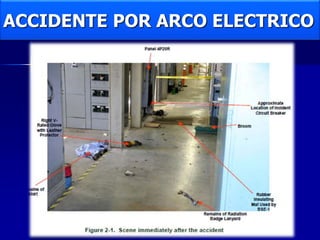 ACCIDENTE POR ARCO ELECTRICO
 