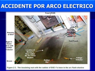 ACCIDENTE POR ARCO ELECTRICO
 