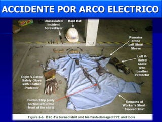 ACCIDENTE POR ARCO ELECTRICO
 