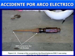 ACCIDENTE POR ARCO ELECTRICO
 