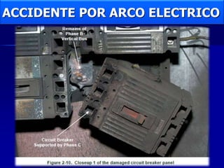 ACCIDENTE POR ARCO ELECTRICO
 
