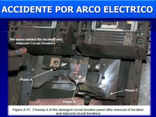 ACCIDENTE POR ARCO ELECTRICO
 