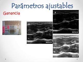 Parámetros ajustables
Ganancia
 