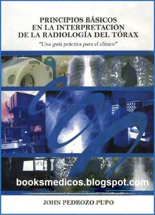 Principios basicos en la interpretacion de la radiologia del torax