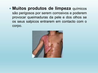  Muitos produtos de limpeza químicos
são perigosos por serem corrosivos e poderem
provocar queimaduras da pele e dos olhos se
os seus salpicos entrarem em contacto com o
corpo.
 