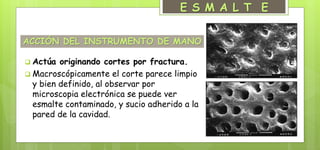 ACCIÓN DEL INSTRUMENTO DE MANO
 Actúa originando cortes por fractura.
 Macroscópicamente el corte parece limpio
y bien definido, al observar por
microscopia electrónica se puede ver
esmalte contaminado, y sucio adherido a la
pared de la cavidad.
E S M A L T E
 