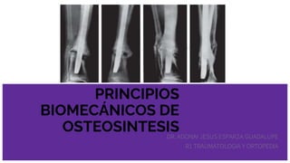 PRINCIPIOS
BIOMECÁNICOS DE
OSTEOSINTESIS
DR. ADONAI JESUS ESPARZA GUADALUPE
R1 TRAUMATOLOGIA Y ORTOPEDIA
 