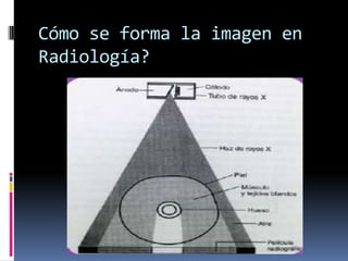 Cómo se forma la imagen en
Radiología?
 