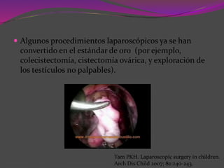  Algunos procedimientos laparoscópicos ya se han
convertido en el estándar de oro (por ejemplo,
colecistectomía, cistectomía ovárica, y exploración de
los testículos no palpables).
Tam PKH. Laparoscopic surgery in children.
Arch Dis Child 2007; 82:240-243.
 