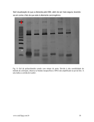 fácil visualização do que a oferecida pelo EtBr, além de ser mais segura, levando-
se em conta o fato de que este é altamente carcinogênico.




Fig. 8: Gel de poliacrilamida corado com nitrato de prata. Devido à alta sensibilidade do
método de coloração, observa-se bandas inespecíficas e DNA não amplificado no pé da foto. A
seta indica a corrida do Ladder.




www.etall.hpg.com.br                                                                18
 