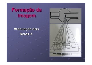 Formação da
  Imagem

Atenuação dos
   Raios X
 