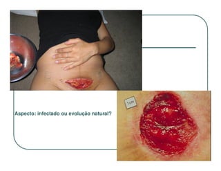 Aspecto: infectado ou evolução natural?
 
