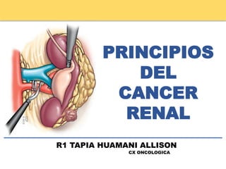 PRINCIPIOS
DEL
CANCER
RENAL
R1 TAPIA HUAMANI ALLISON
CX ONCOLOGICA
 