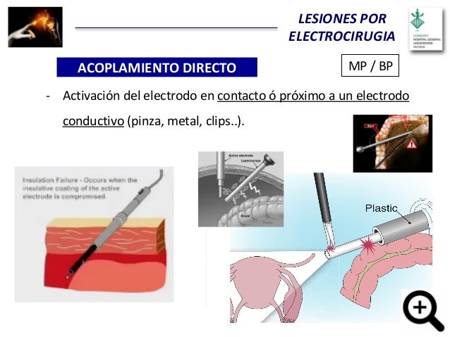 Principios de electrocirugía