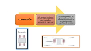 .
COMPRESIÓN
Es la carga que produce el
cirujano entre fragmentos
óseos mediante la
utilización de implantes
Dar estabilidad entre los
fragmentos de una fractura
mediante el incremento de
la fricción entre sus
superficies de contacto
 