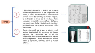 Compresión transversal: Es la carga que se ejerce
en sentido perpenticular al eje longitudinal del
hueso, la fuerza resultante será la suma vectorial
entre la acción del tornillo y las fuerzas propias a
la inclinación al trazo de la fractura. Trazos
oblicuos y helicoidales en metáfisis y diáfisis de
huesos cortos y fíbula. Principalmente tornillos y
ocasionalmente placas, entre otros como cables
o alambres
Compresión axial :es la que se ejerce en el
sentido longitudinal del segmento del hueso
afectado. La compresión es en el eje
longitudinal de la diáfisis del hueso o de alguno
de sus segmentos. Trazos transversales. Placas
rectas y especiales, tornillos, clavos y fijador
externo.
TIPOS
 