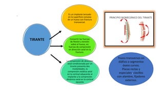 . Es un implante tensado
en la superficie convexa
de un hueso con fractura
transversal.
Convertir las fuerzas
de flexión y tensión
sobre el hueso, en
fuerzas de compresión
en dirección axial en la
fractura.
La compresión de dirección
axial condicionada por un
tirante presenta dos
modalidades, la
compresión estática axial
en la cortical adyacente al
implante y la compresión
dinámica axial en la cortical
opuesta.
TIRANTE
Trazos transversos en
diáfisis o segmentos
óseos curvos.
Placas rectas y
especiales, clavillos
con alambre, fijadores
externos.
 