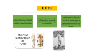 .
TUTOR
Implante que alinea, estabiliza y
guía a los fragmentos óseos a que
contacten entre sí de manera
dinámica y hacia la consolidación
Dirigir los fragmentos óseos de
manera dinámica, propiciando
carga axial entre ellos para lograr
su consolidación
Generalmente se realiza con clavos
intramedulares. La indicación
precisa para la aplicación de este
principio de forma aislada es la
presencia de una fractura de trazo
transverso dentro del istmo de la
diáfisis ósea de huesos con carga
ponderal.
 