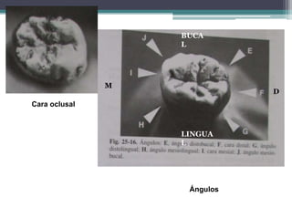 BUCA
L

M

D

Cara oclusal

LINGUA
L

Ángulos

 