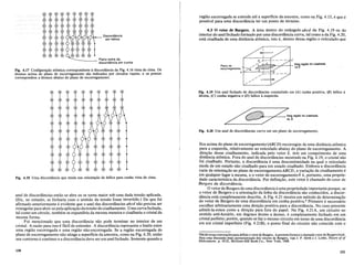 Diseordaneia
em haliee
Plano extra da.
- - - - - diseordaneia em eunha
Fig. 4.17 Configura9ao atomica correspondente adiscordiincia da Fig. 4.16 ,:ista de cima. Os
,itomos acima do plano de escorregamento sao indicados por circulos VazIOS, e os pontos
correspondem a ,itomos abaixo do plano de escorregamento.
Fig. 4.18 Uma discordiincia que muda sua orienta9ao de Mlice para cunha vista de cima.
anel de discordancias entao se abre ou se torna maior sob uma dada tensao aplicada.
(Ele, no entanto, se fecharia caso 0 sentido da tensao fosse invertido.) Do que foi
afirmado anteriormente e evidente que 0 anel das discordaneias abed nao precisa ser
retangular para abrir-se pelaaplica9ao da tensao decisalhamento. Urna curvafechada,
tal como urn circulo, tambem se expandiria da mesma maneira e cisalharia 0 cristal da
mesma forma.
Foi mencionado que uma discordancia nao pode terminar no interior de urn
cristal. A razao para isso e faeil de entender. A discordancia representa 0 limite entre
uma regiao escorregada e uma regiao nao-escorregada. Se a regiao escorregada do
plano de escorregamento nao atinge a superfieie da amostra, como na Fig. 4.20, enta~
seu contorno e continuo e a discordancia deve serum anel fechado. Somente quando a
130
regiao escorregada se estende ate a superficie da amostra, como na Fig. 4.15, e que e
possivel para uma discordancia ter urn ponto de termino.
4.3 0 vetor de Burgers. A area dentro do remngulo abed da Fig. 4.19 ou do
interior do anel fechado formado por uma discordancia curva, tal como a da Fig. 4.20,
esm cisalhada de uma distaneia atomica, isto e, dentro dessa regiao 0 reticulado que
c
:~~~~~7':::::---J~ Eata regilio foi cisalhada
Piano de c de'5
eacorregamento b
Ar-~---='--i---r!!.. _
/'
/'
/' T
/'
/'
Fig. 4.19 Urn aneI fechado de discordiincias consistindo em (A) cunha positiva, (B) Mlice a
direita, (C) cunha negativa e (D) Mlice aesquerda.
Fig. 4.20 Urn anel de discordiincias curvo em urn plano de escorregamento.
fica acima do plano de escorregamentO'(ABCD) escorregou de uma dismncia atomica
para a esquerda, relativamente ao reticulado abaixo do plano de escorregamento. A
dire9ao desse eisalhamento, indicada pelo vetor G, tern urn comprimento de uma
dismncia atomica. Fora do anel de discordancias mostrado na Fig. 4.19, 0 cristal nao
foi cisalhado. Portanto, a discordancia e uma descontinuidade na qual 0 reticulado
muda de urn estado nao cisalhado para urn estado cisalhado. Embora a discordancia
varie de orienta9ao no plano de escorregamentoABCD, a yaria9ao de cisalhamento e
em qualquer lugar a mesma, eo vetor de escorregamento b e, portanto, uma proprie-
dade caracteristica da discordancia. Por defini9ao, este vetor e chamado de vetor de
Burgers da diseordfincia.
ovetor de Burgers de uma discordancia e uma propriedade.kmportante porque, se
o vetor de Burgers e a orienta9ao da linha da discordancia sao conhecidos, a discor-
dancia esm completamente descrita. A Fig. 4.21 mostra urn metodo de determina9ao
do vetor de Burgers de uma discordancia em cunha positiva.6 Primeiro e necessario
escolher arbitrariamente uma dire9ao positiva para a discordancia. No caso presente
admiti-la-emos como a dire9ao para fora do papeL Na Fig. 4.21A, urn circuito no
sentido anti-homrio, em degraus atomo a atomo, e completamente fechado em urn
cristal perfeito; porem, quando se faz 0 mesmo circuito em torno de uma discordaricia
em urn cristal imperfeito (Fig. 4.21B), 0 ponto final do circuito nao coincide com 0
6Ha diversas conve~6espara definir0 vetorde Burgers. Apresentefomece 0 chamado vetor de Burgers local.
Para uma discussao mais pormenorizada dqs vetores de Burgers, veja J. P. Hirth e J. Lothe, Theo.r;:o!o.!
Dislocations, p. 19-22, McGraw-Hill BookjCo., New York, 1968.
131
 