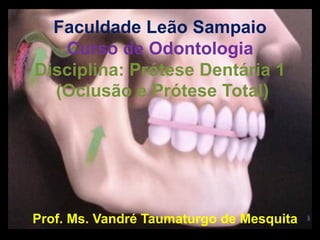 Faculdade Leão Sampaio
Curso de Odontologia
Disciplina: Prótese Dentária 1
(Oclusão e Prótese Total)

Prof. Ms. Vandré Taumaturgo de Mesquita

 