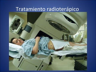 Tratamiento radioterápico  
