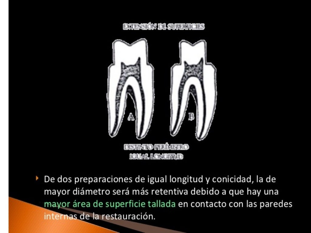 Principios de tallado dental 3