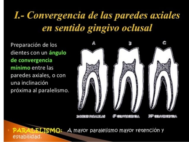 Principios de tallado dental 3