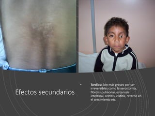 PRINCIPIOS DE TRATAMIENTO ONCOLOGICO. Generalidades | PDF