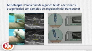 Anisotropía : Propiedad de algunos tejidos de variar su
ecogenicidad con cambios de angulación del transductor
 