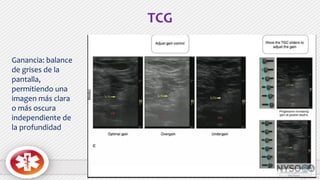 TCG
Ganancia: balance
de grises de la
pantalla,
permitiendo una
imagen más clara
o más oscura
independiente de
la profundidad
 