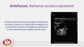 Artefactos: Refuerzo acústico posterior
El ultrasonido atraviesa un medio sin interfase en
su interior y pasa a un medio sólido ecogénico. Es
característica exclusiva de imágenes quísticas en
el seno de estructuras sólidas o de los vasos
 