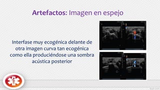 Artefactos: Imagen en espejo
Interfase muy ecogénica delante de
otra imagen curva tan ecogénica
como ella produciéndose una sombra
acústica posterior
 