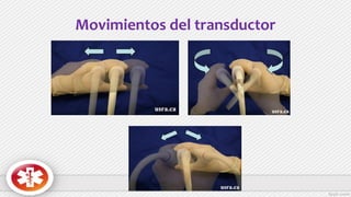 Movimientos del transductor
 