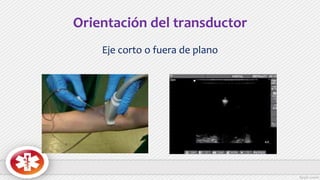 Orientación del transductor
Eje corto o fuera de plano
 